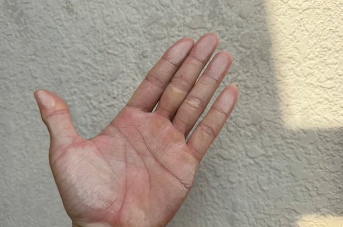 【写真2】素手で外壁を擦った際、白い粉が付着するチョーキング現象を確認